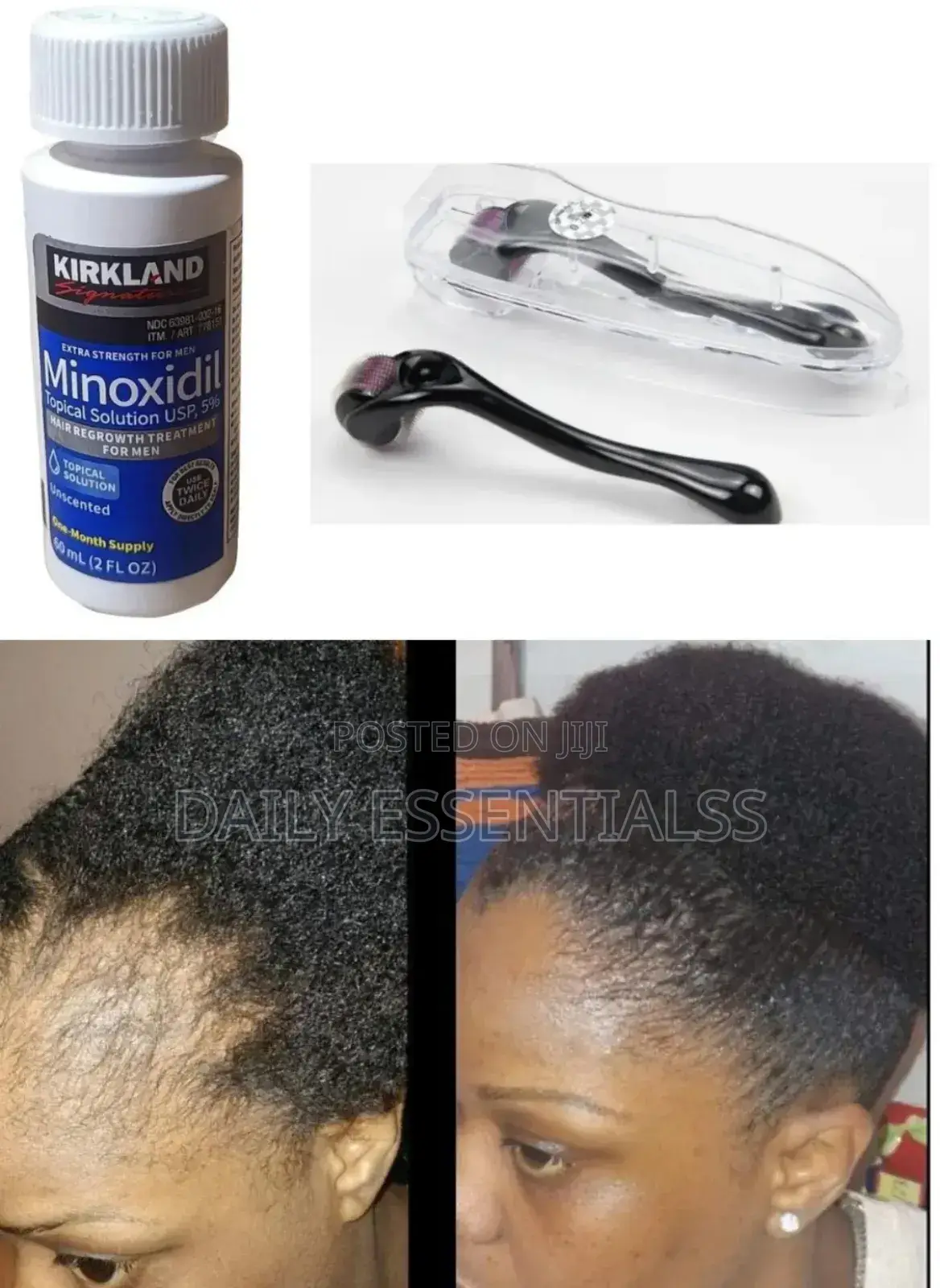 Kirkland Derma Roller Kit