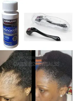Kirkland Derma Roller Kit
