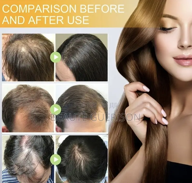 Advanced Biotin Max Vitamin Reviving Serum