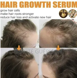 Advanced Biotin Max Vitamin Reviving Serum