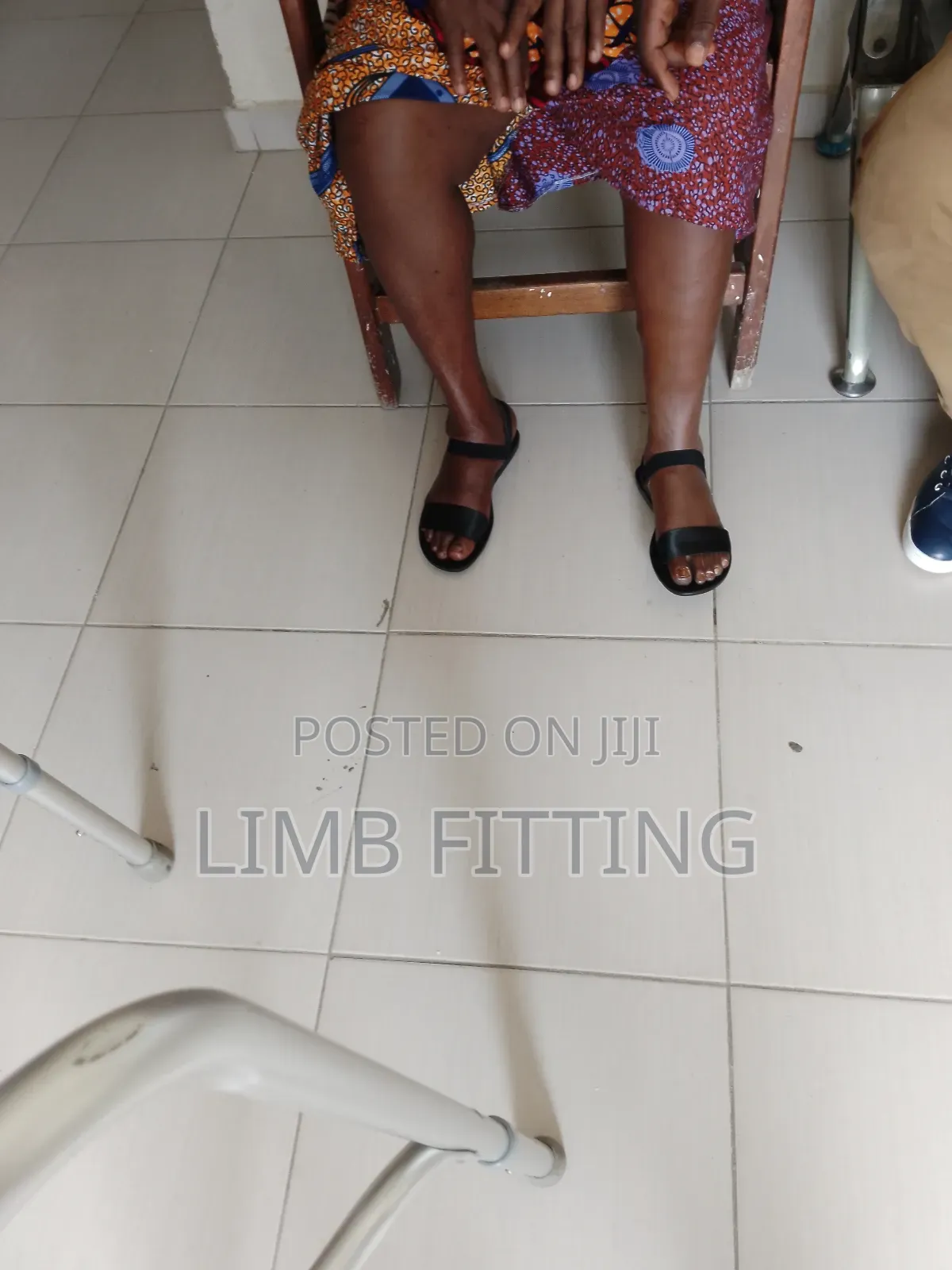 Prosthesis, (Artificial Leg) Foot Rehabilitation