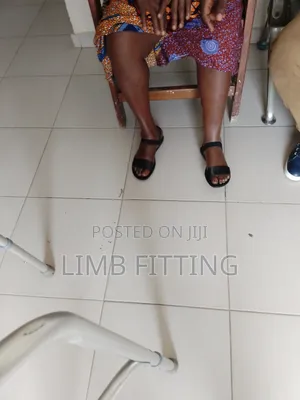 Prosthesis, (Artificial Leg) Foot Rehabilitation