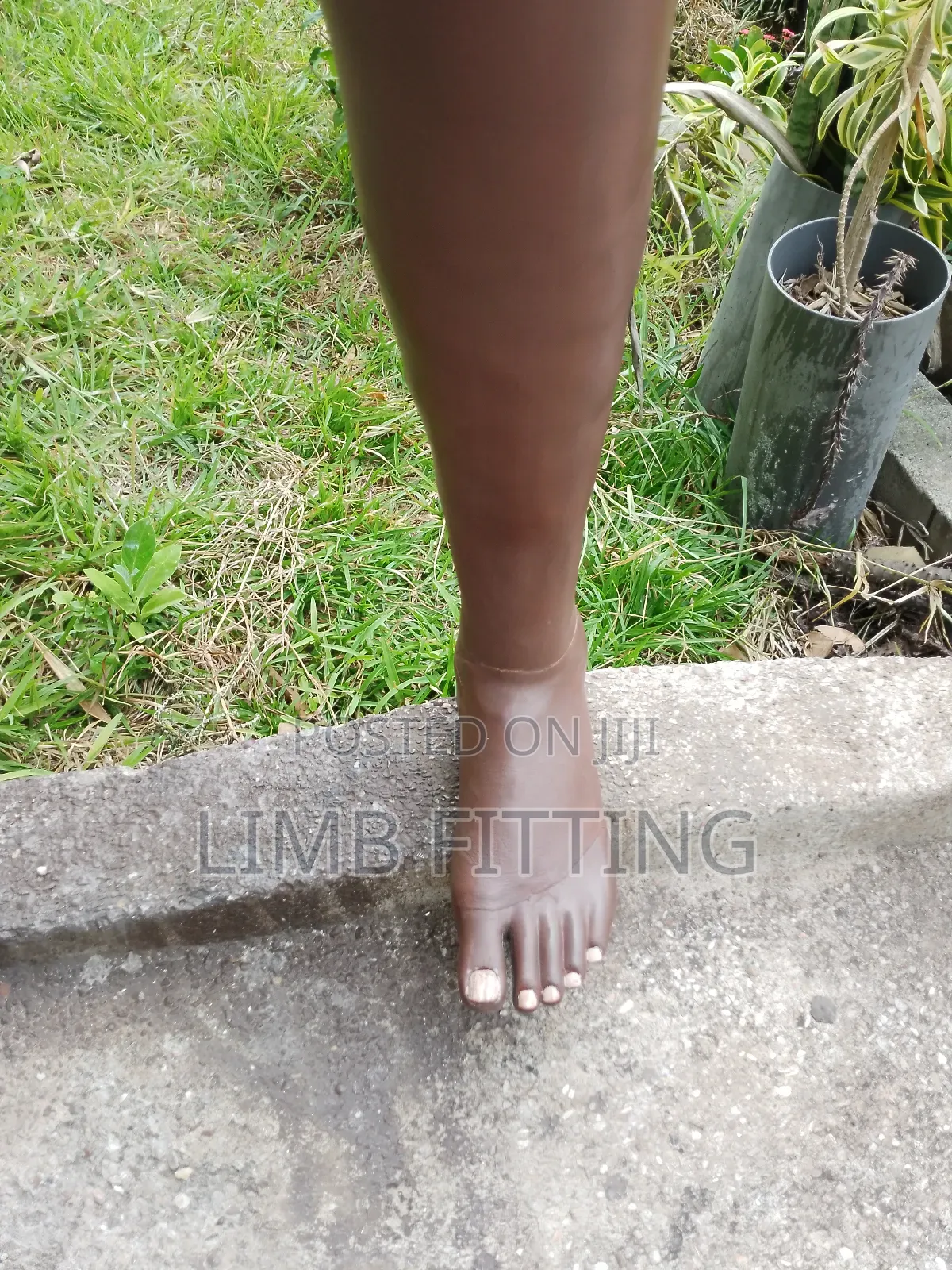 Prosthesis, (Artificial Leg) Foot Rehabilitation