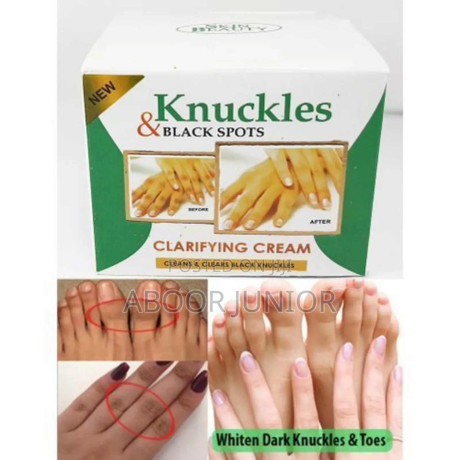 Dark Knuckles Remover