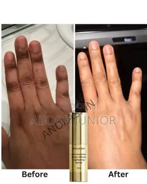 Dark Knuckles Remover