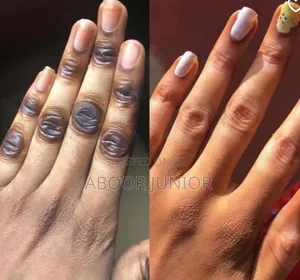 Dark Knuckles Remover