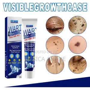 Eelhoe Skin Tags and Warts Remover Ointment