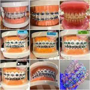 Fashion Braces( Glue-Type)