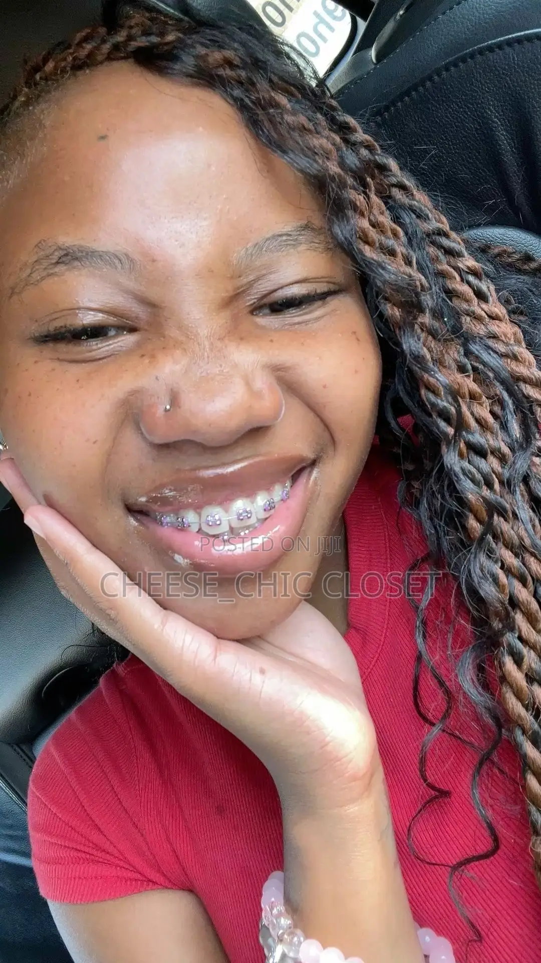 Fashion Braces( Glue-Type)
