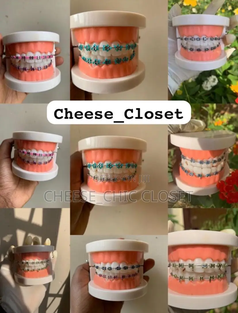 Fashion Braces( Glue-Type)