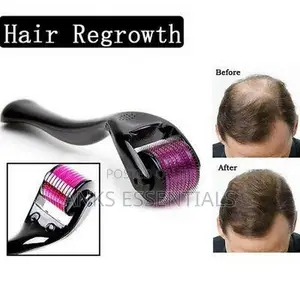 Derma Roller 1.0mm – Hair Growth Skin Glow Tool