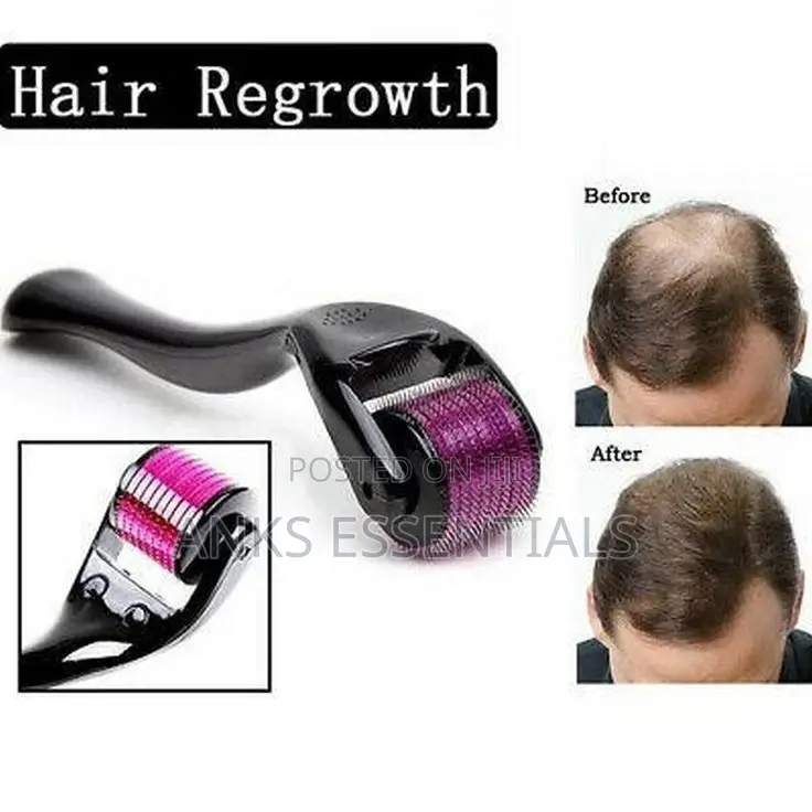 Derma Roller 1.0mm – Hair Growth Skin Glow Tool