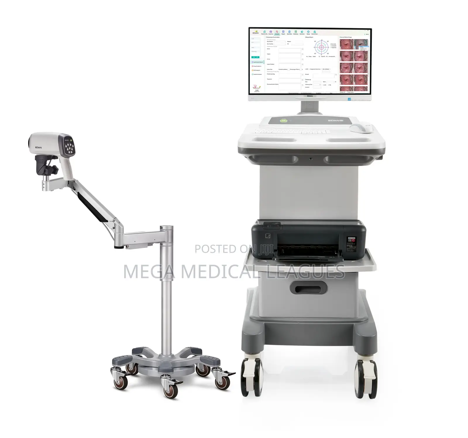 Edan C6 Hd Electronic Colposcope