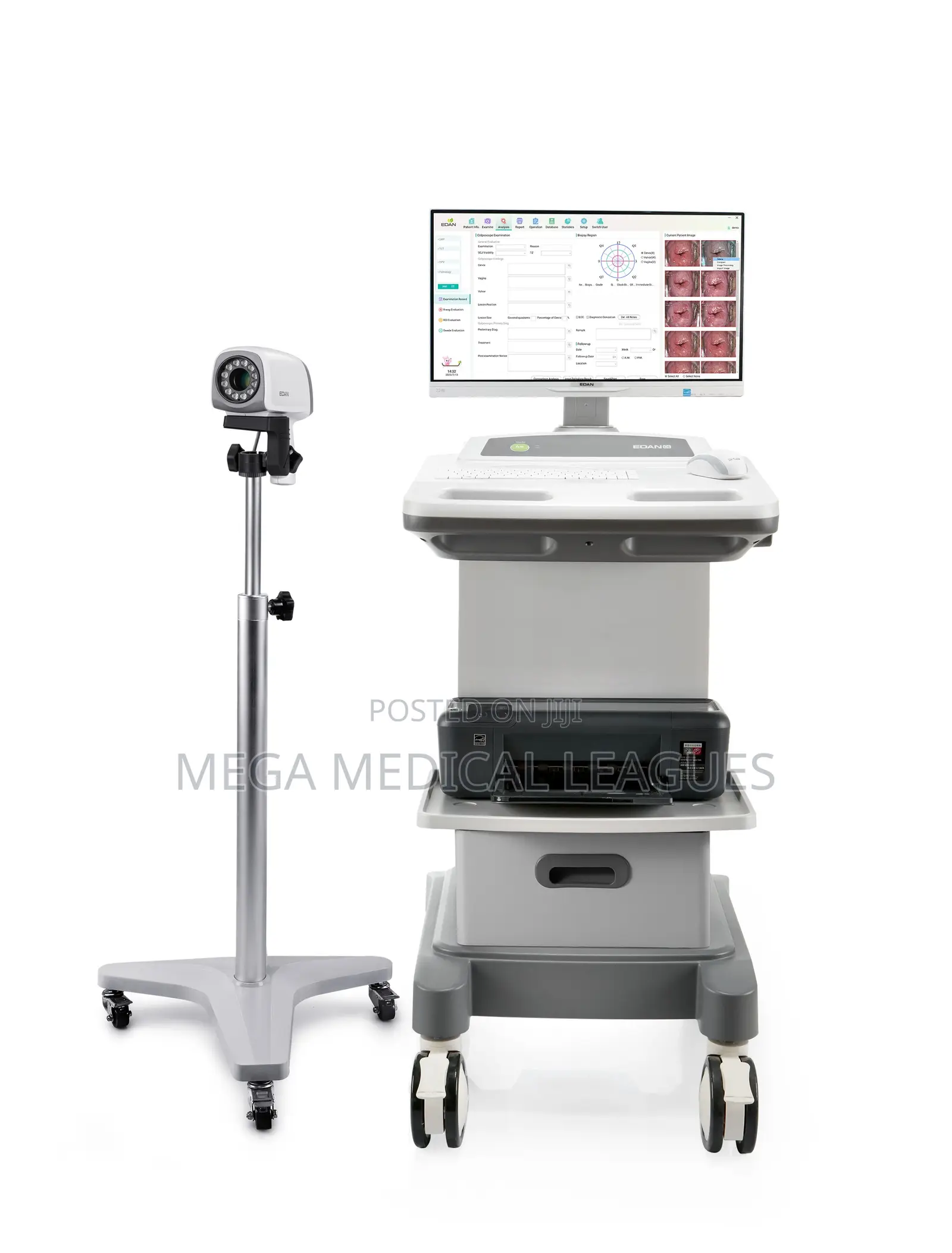 Edan C6 Hd Electronic Colposcope