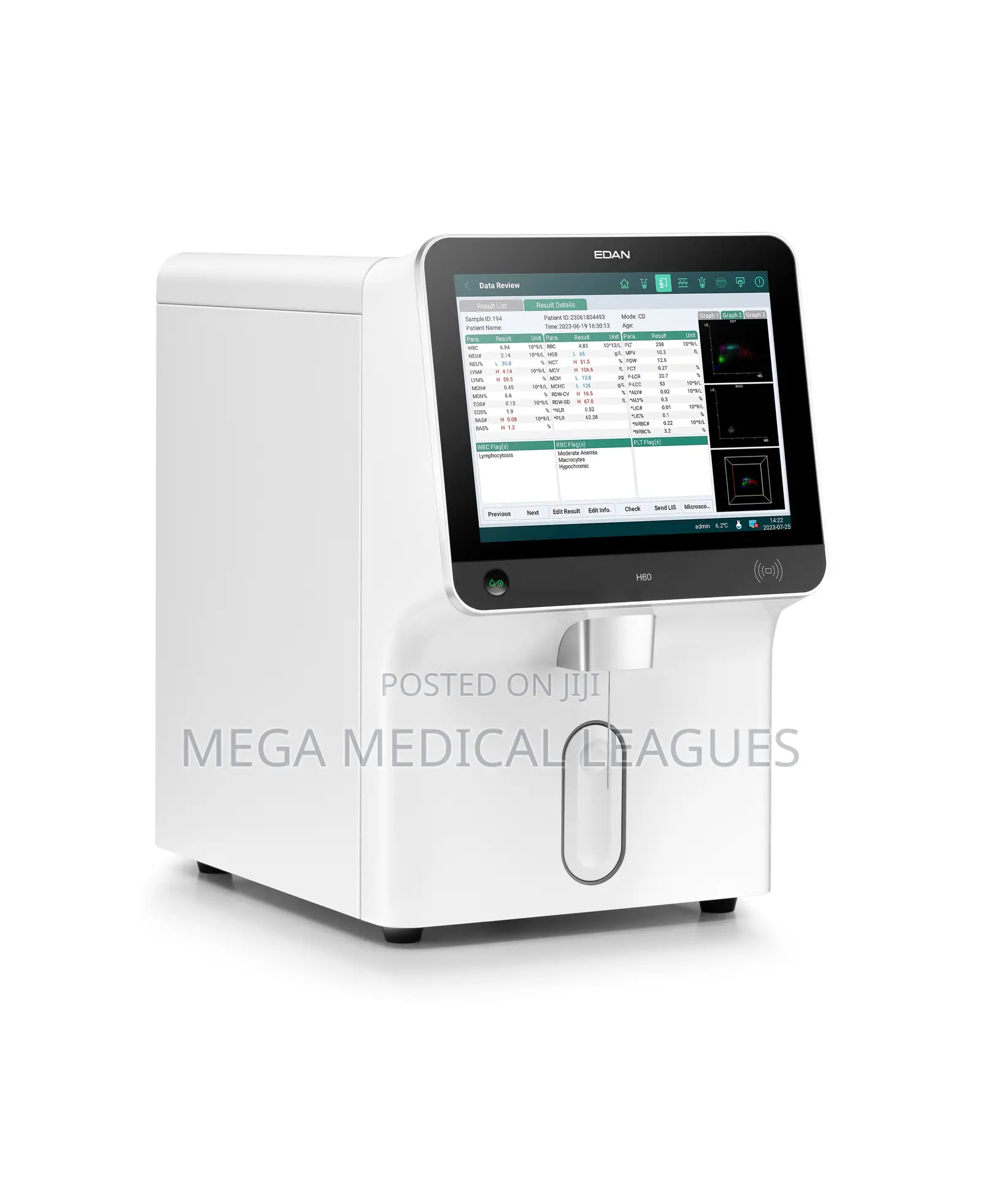 Fully Automatic Five-Part Differential Hematology Analyzer Edan H60s