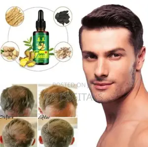 Ginger Hair Beard Serum – Thicker, Healthier Growth