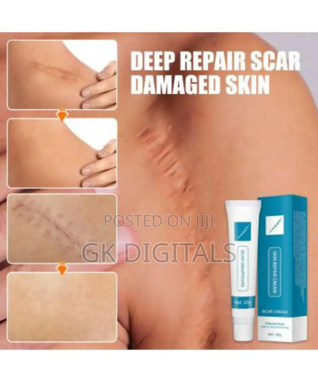 Skin Repair Cream