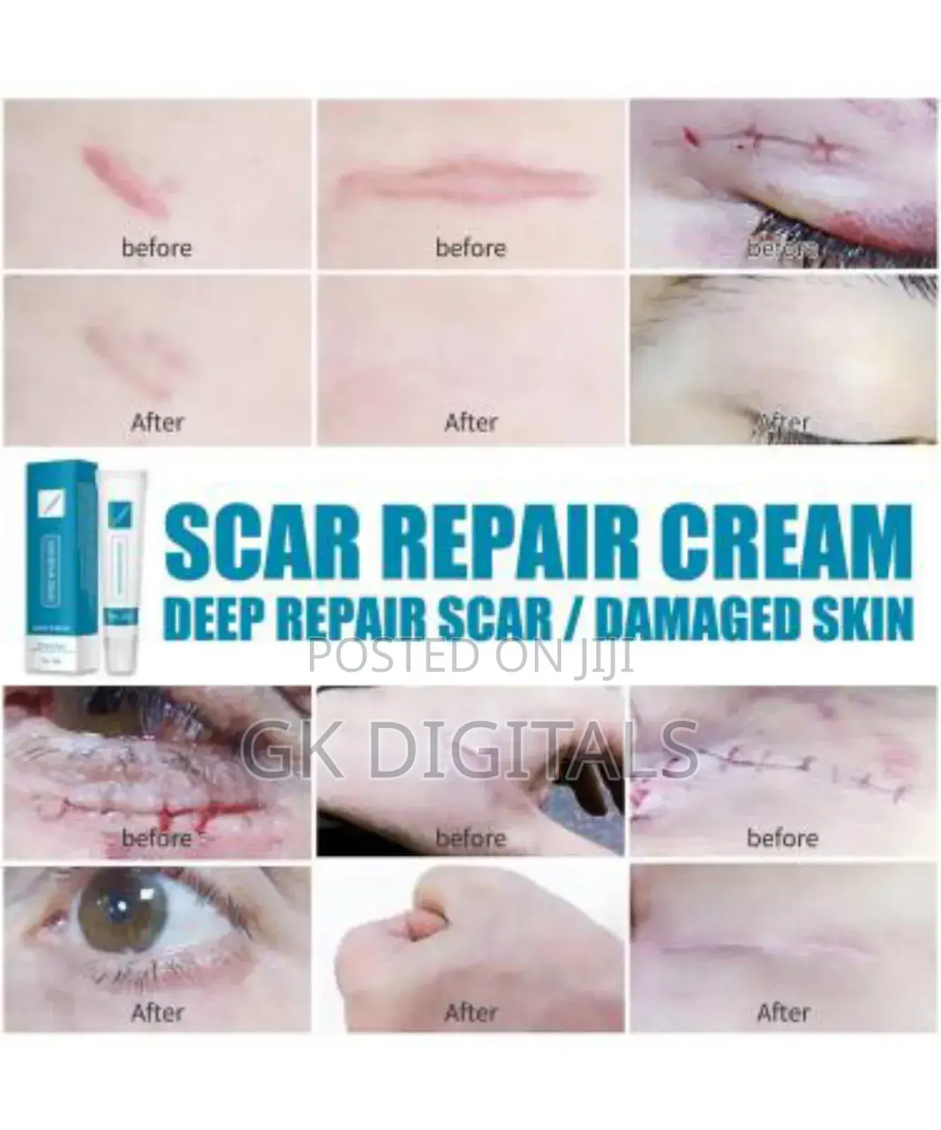 Skin Repair Cream