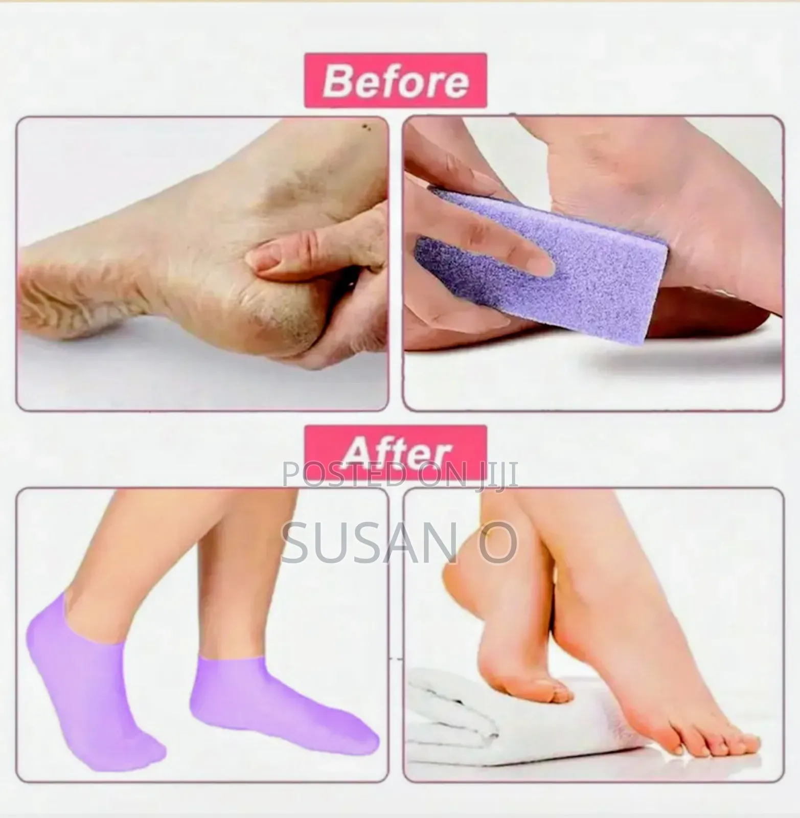 Silicone Moisturizing Socks