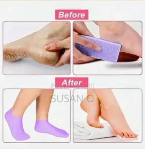 Silicone Moisturizing Socks