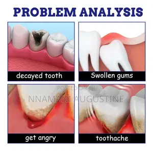 Teeth Pain Relief Spray