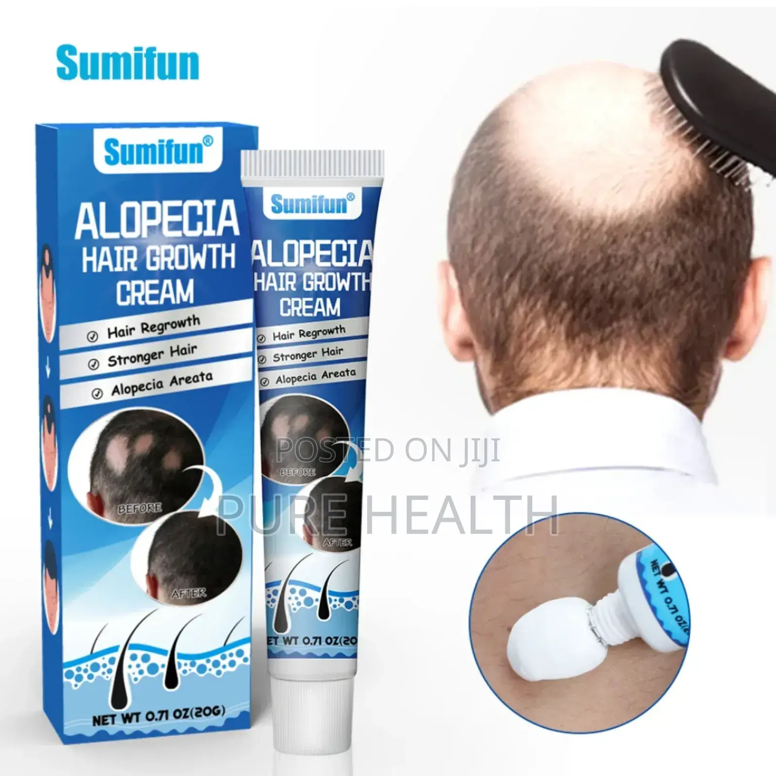 Alopecia Hair Growth Cream