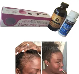 Kirkland Oil, Castor Oil Roller Combo
