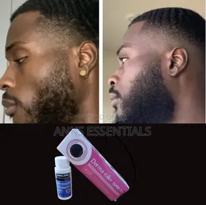 Hair Growth Treatment – Kirkland Oil + Roller