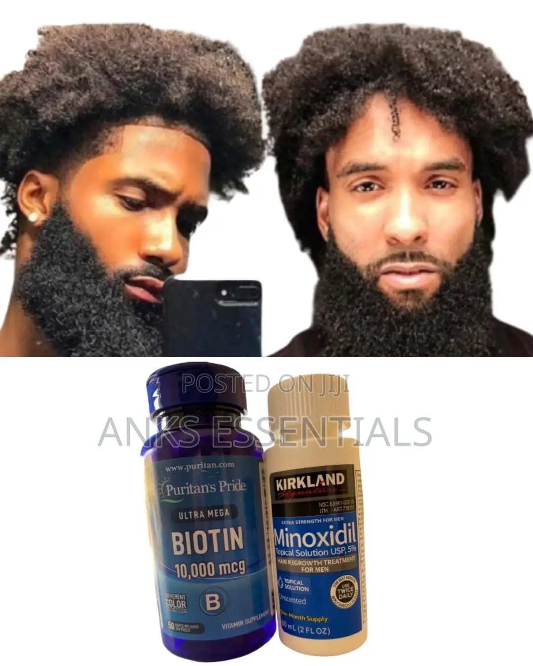 Hair Growth Combo – Kirkland Foam + Biotin + Derma Roller