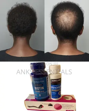 Original Kirkland Biotin Combo – Hair Growth Support