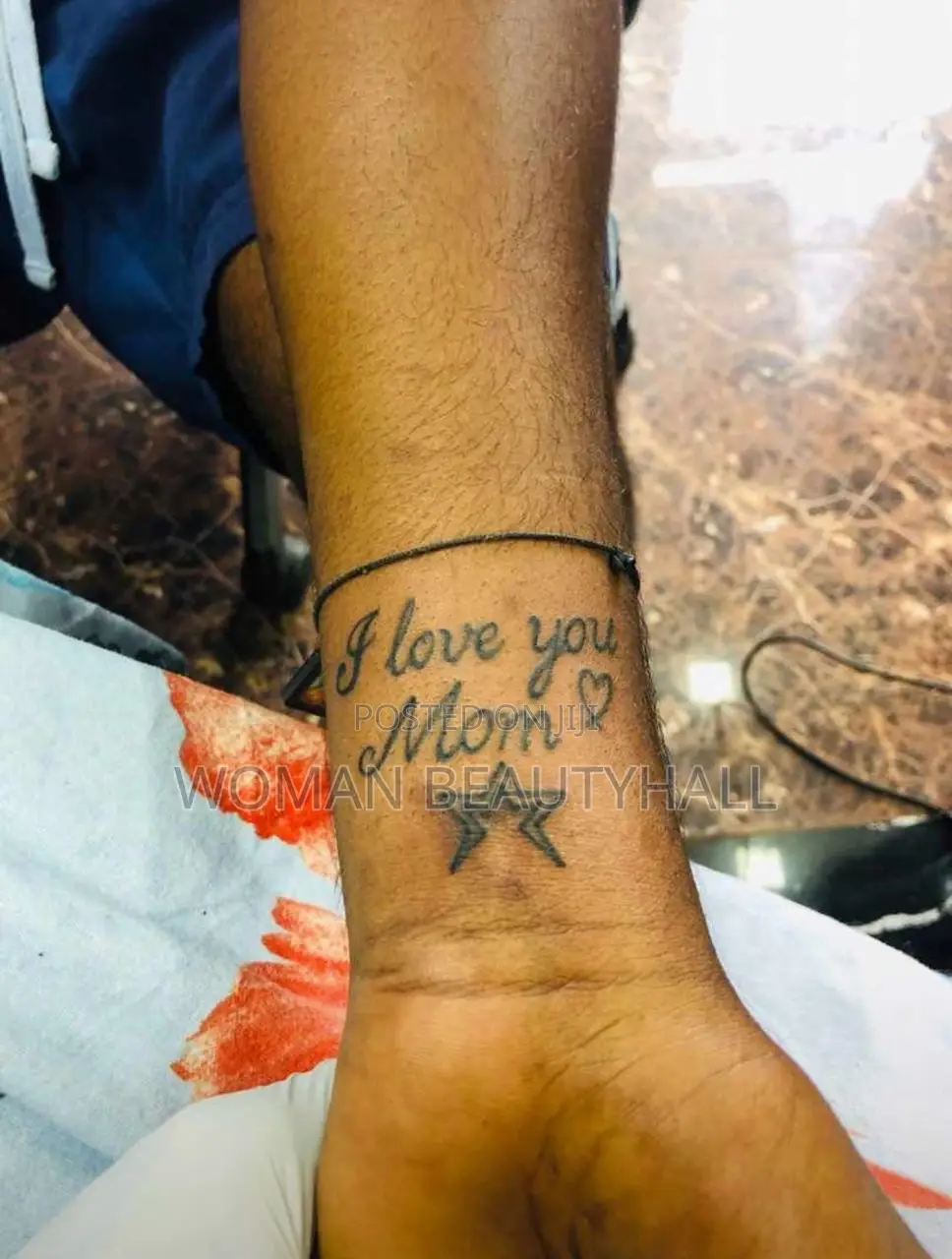 Tattoo Removal