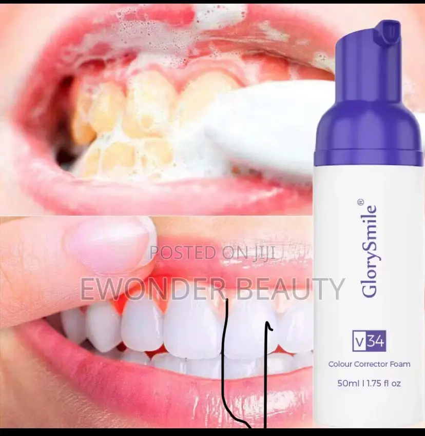 Teeth Whitening