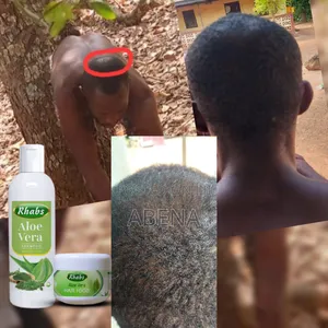 Bald Head Solution