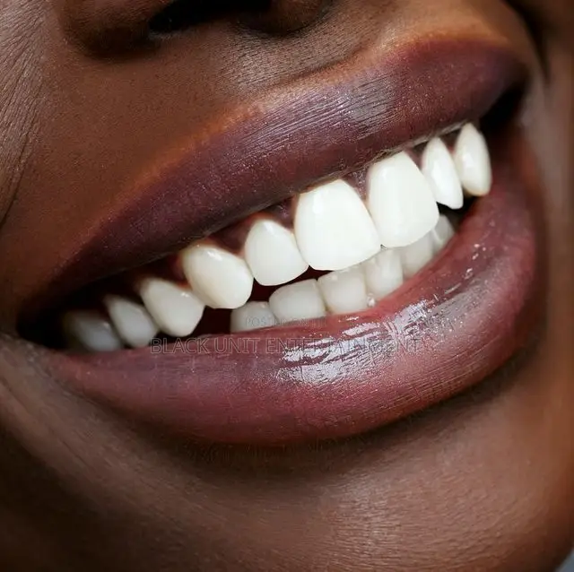 Teeth Whitening Studio