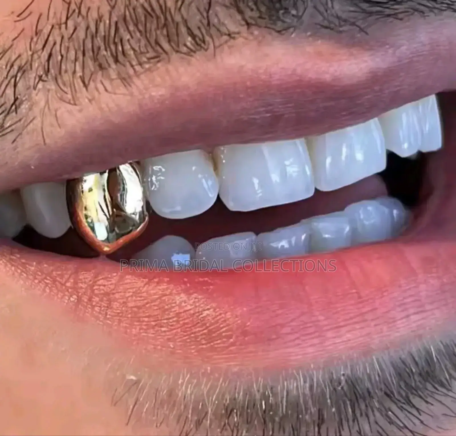 Grillz Teeth