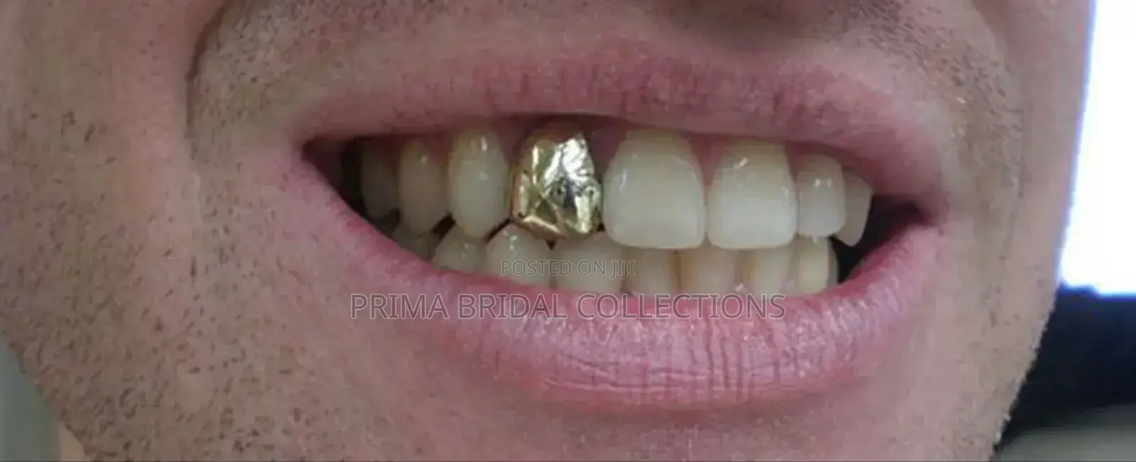 Grillz Teeth