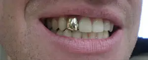 Grillz Teeth