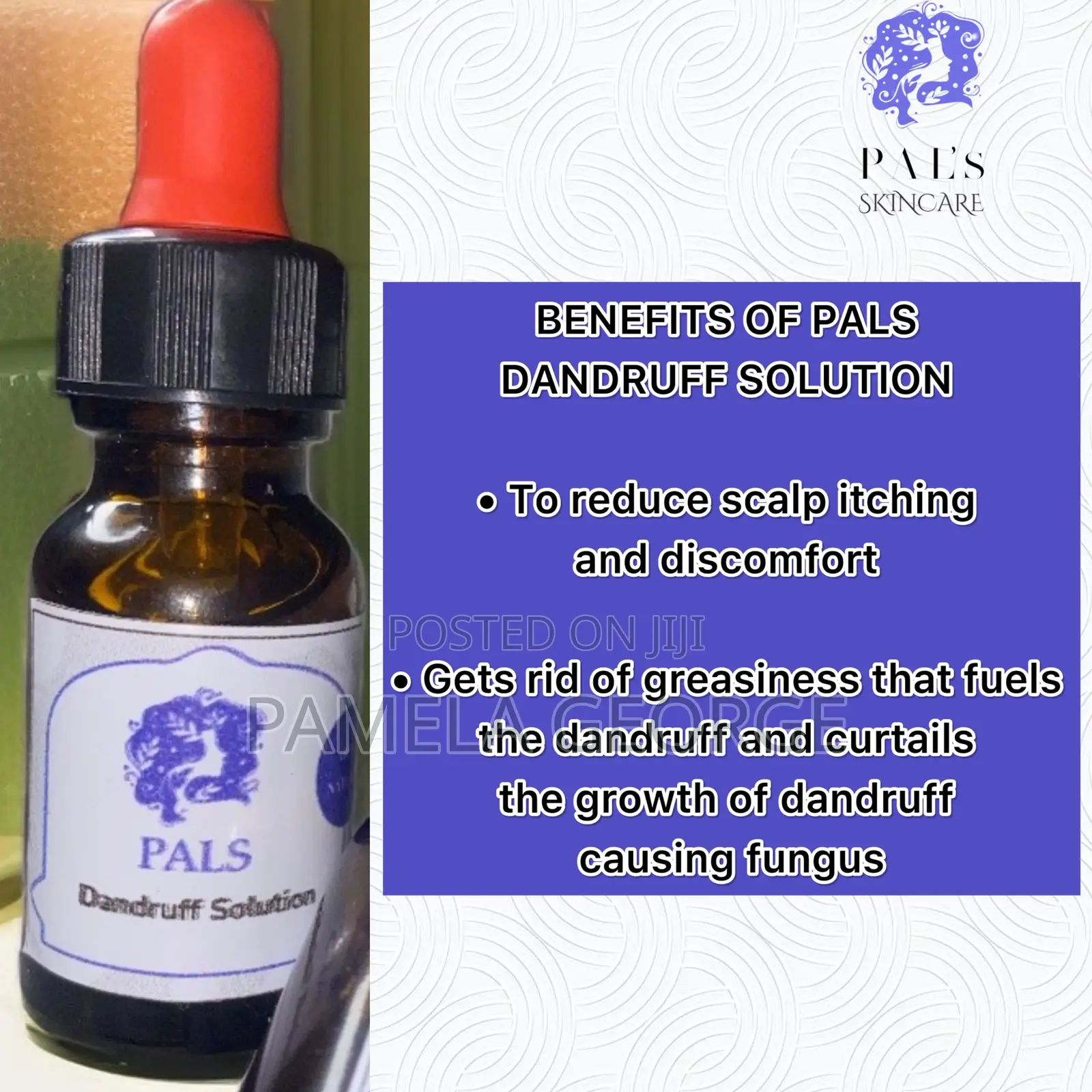 Dandruff Solution and Itchy Scalp Solution