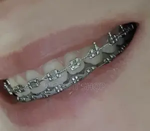 Teeth Braces