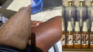 F8t Stretchmarks Removal Oil