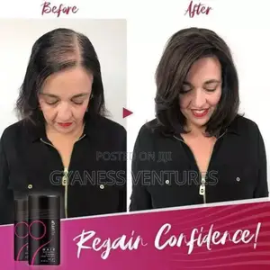 Sevich Hair Fiber