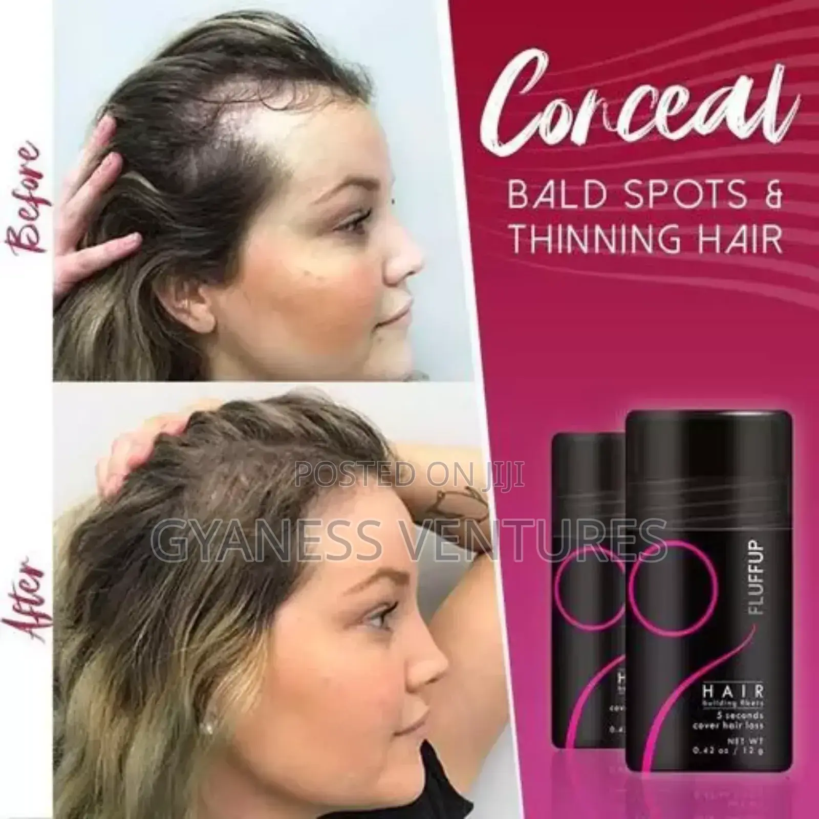 Sevich Hair Fiber