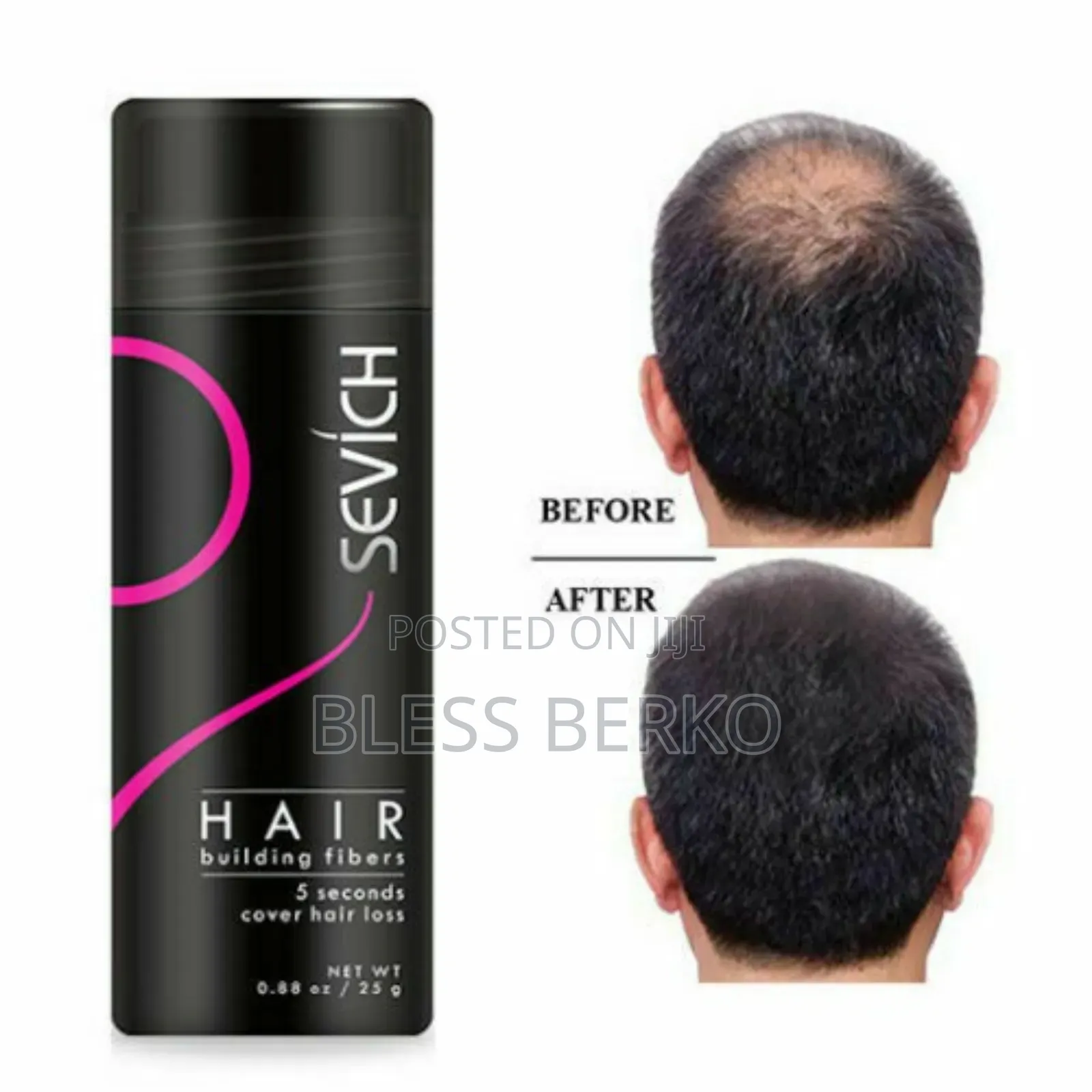 Sevich Hair Fiber