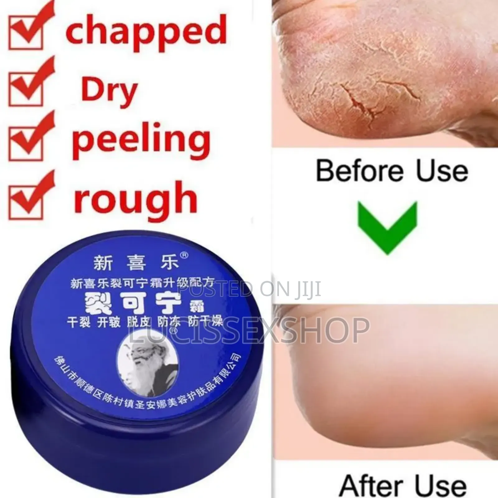 Anti Crack Foot Cream
