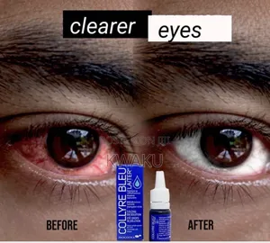 Collyre Bleu Whitening Eye Drops
