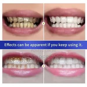Breyle Teeth Whitening Powder