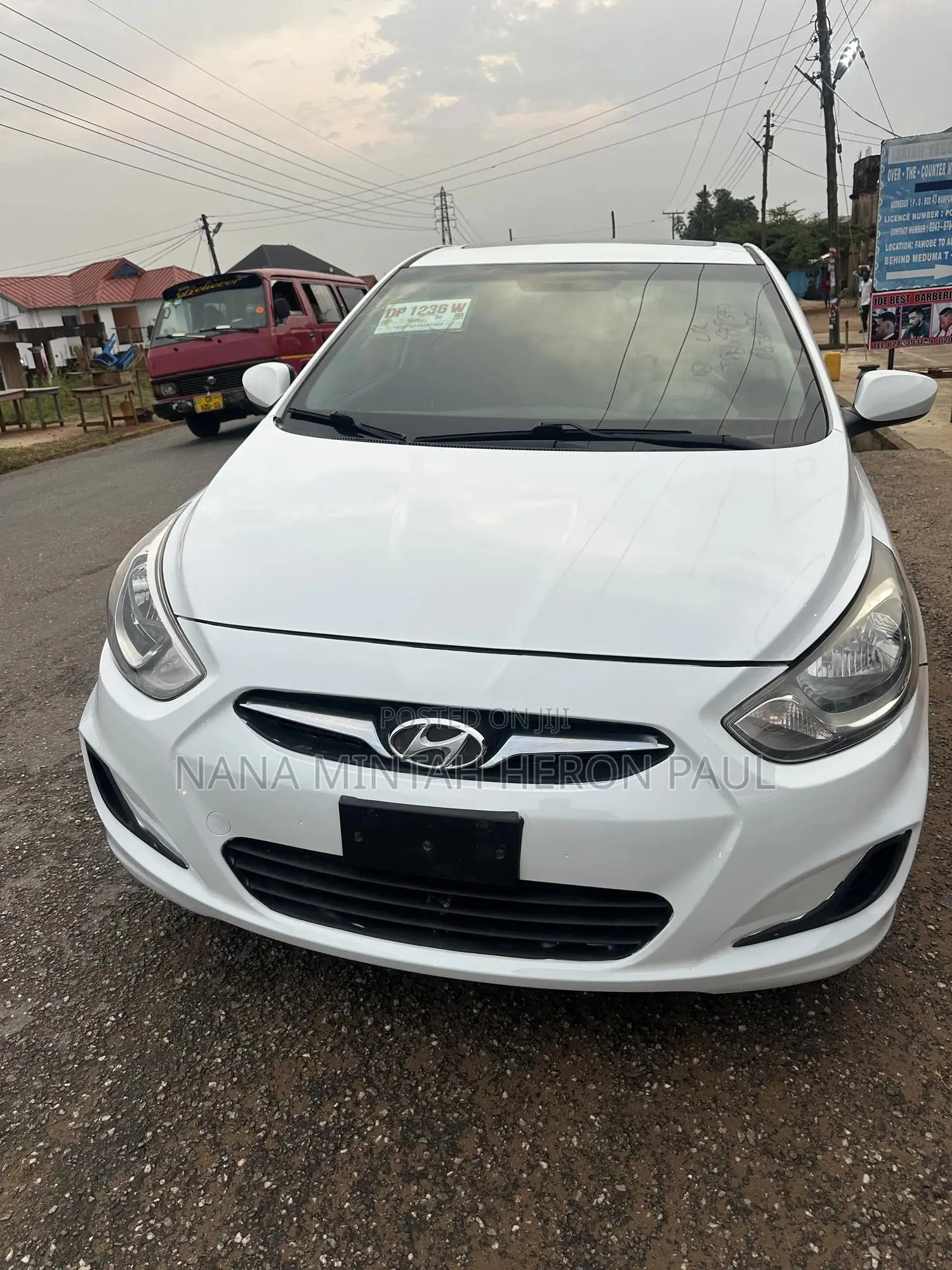 Hyundai Accent SE Hatchback 2017 White