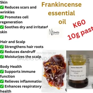 Frankincense Essential Oil
