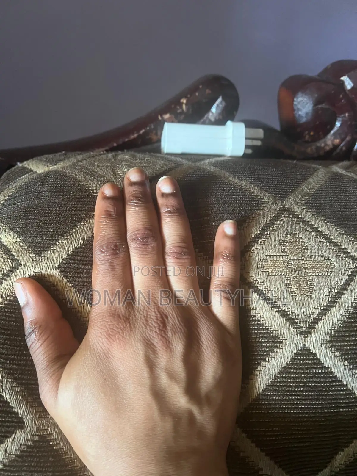 Dark Knuckles Laser Treatment
