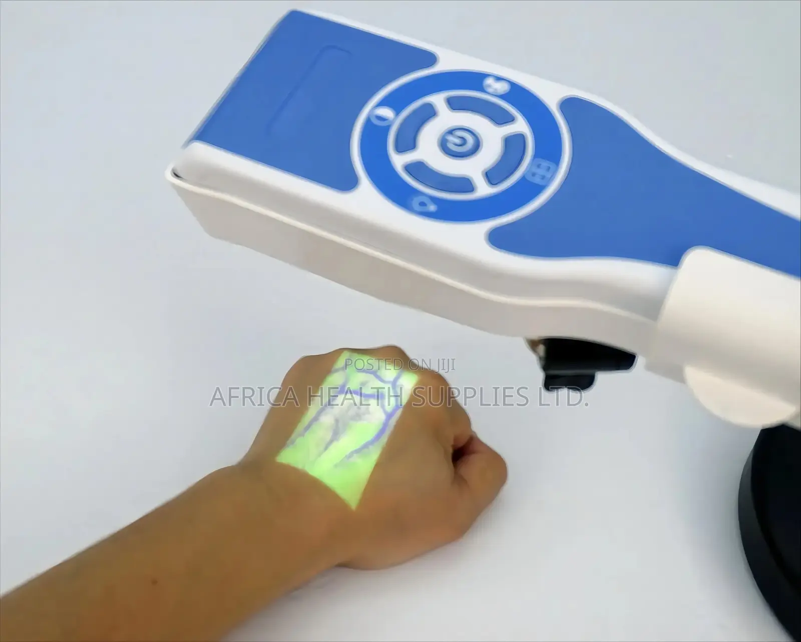 Vein Finder